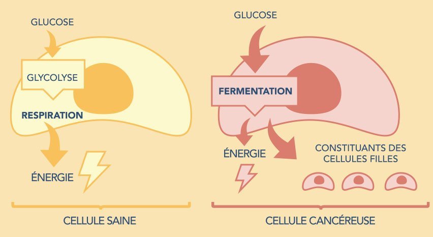 Cellules cancéreuses