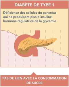 Diabète de type 1